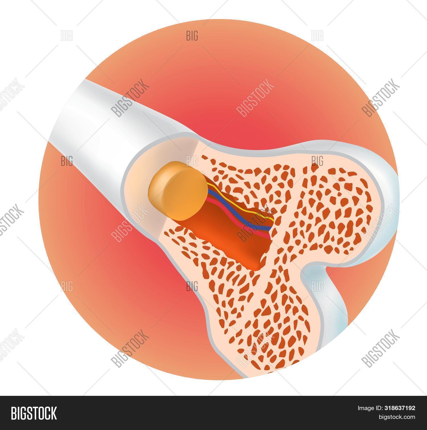 Bone Structure. Image & Photo (Free Trial) | Bigstock