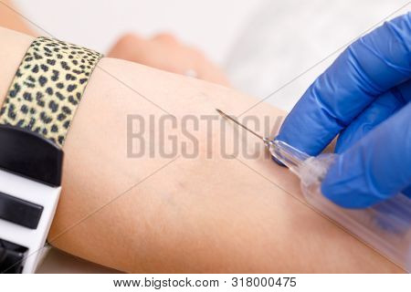 Close-up shot of doctor or nurse ready to take a blood sample from arm vein with a vacutainer. Venipuncture or venepuncture procedure