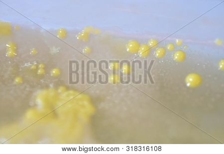 Colony Of Bacteria In Culture Medium Plate, Microbiology.