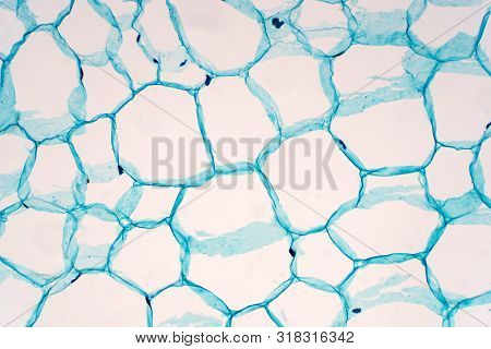 Cross Sections Of Plant Stem Under Microscope View Show Structure Of Parenchyma Cells For Education 