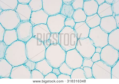 Cross Sections Of Plant Stem Under Microscope View Show Structure Of Parenchyma Cells For Education 