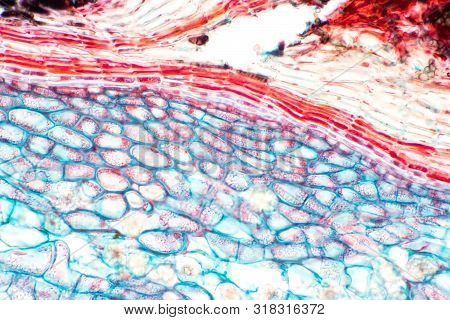 Cross Sections Of Plant Stem Under Microscope View Show Structure Of Collenchyma Cells For Education