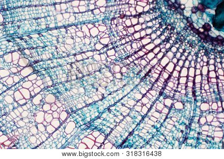 Cross Section - Xylem Is A Type Of Tissue In Vascular Plants That Transports Water And Some Nutrient