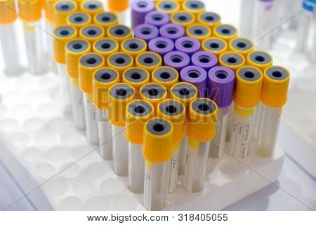 Selective Focus A Group Of Medical Sample Tube Yellow And Purple Color