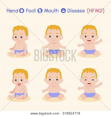 Set Of Baby Children Infected And Healthy, Boy Have A Hand Foot Mouth Disease, Hfmd In Rain Season, 