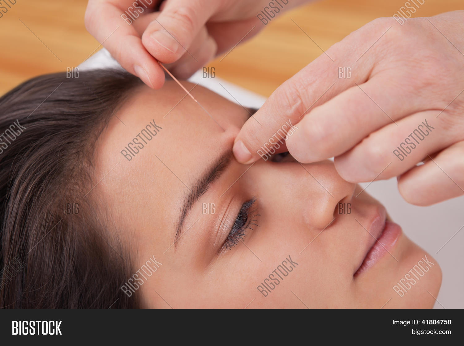 Acupuncture Needles On Image & Photo (Free Trial) Bigstock