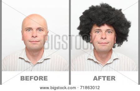 Hairless man and man with beautiful hair. Compare of before and after use your new hair shampoo.