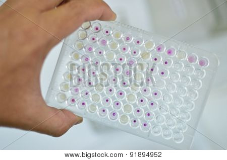 HIV testing by using microplate