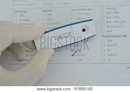 HIV negative