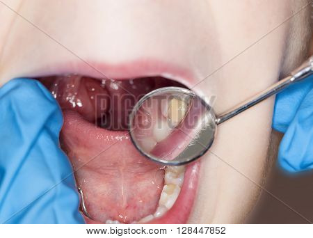inspection of the oral kid cavity dental dentist
** Note: Shallow depth of field