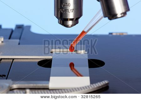 Photo of a laboratory microscope with a blood sample on a glass slide.