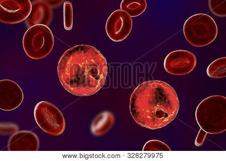 The Malaria-infected Red Blood Cell. 3d Illustration Showing Parasite Plasmodium Malariae In The Sta