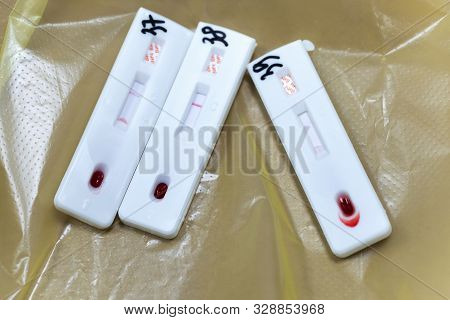 Russian Test Iha Hiv 1/2-factor For Express Diagnosis Of Specific Antibodies To Human Immunodeficien