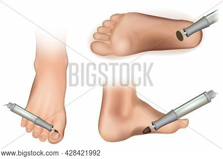 Apparatus For Hardware Pedicure. Cutters And Accessories And Nail Tool On White Background.cutter Fo