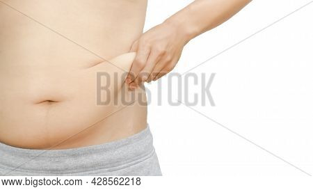 An Image Of An Obese Man Squeezing His Belly Fat Shows Obesity Against A White Background.