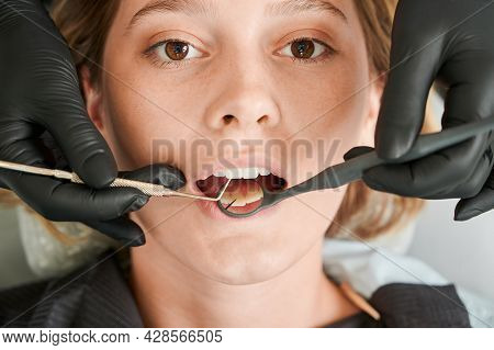 Close Up Of Stomatologist Hands Checking Female Patient Teeth. Young Woman With Open Mouth Looking A