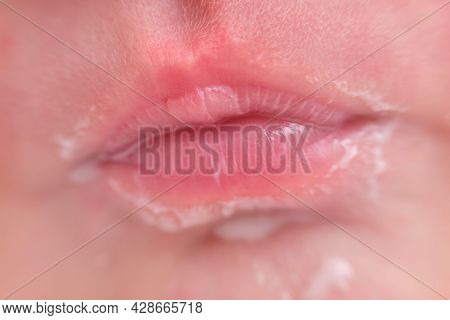 Lips In Milk On The Face Of A Newborn Baby, Close-up. Macro Photo Of A Healthy Child Mouth After Fee