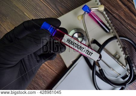 Hematocrit - Test With Blood Sample. Top View Isolated On Office Desk. Healthcare/medical Concept