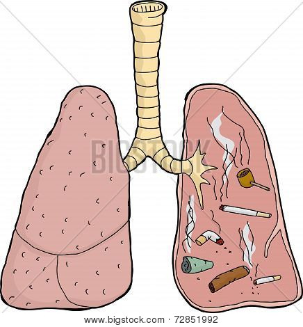 Isolated Dirty Lungs