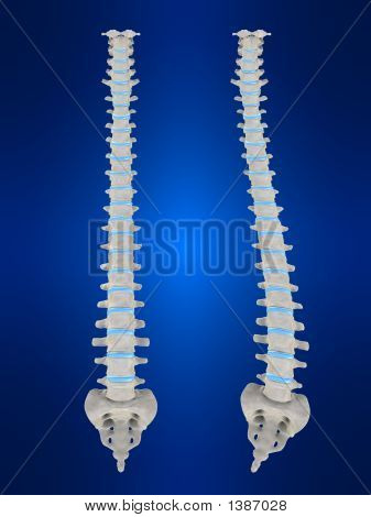 Scoliose