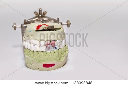 Technical shots of model on a dental prothetic laboratory
