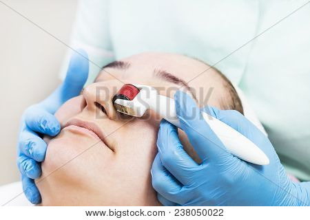 The Woman Undergoes The Procedure Of Medical Micro Needle Therapy With A Modern Medical Instrument D