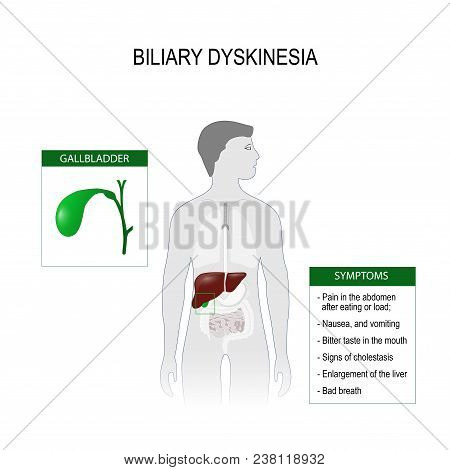 Biliary Dyskinesia Is A Disorder Of Biliary Part Of The Digestive System In Which Bile Can Not Move 