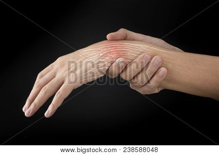 Wrist Bones Injury Black Background Wrist Pain