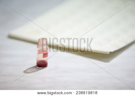 Medical Jar With Blood.laboratory Of Blood.microbiological Examination Of Blood