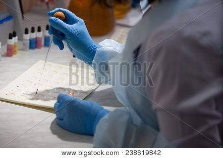Blood Test.microbiological Examination Of Blood.laboratory Of Blood