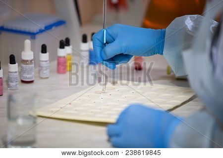 Blood Test.microbiological Examination Of Blood.laboratory Of Blood