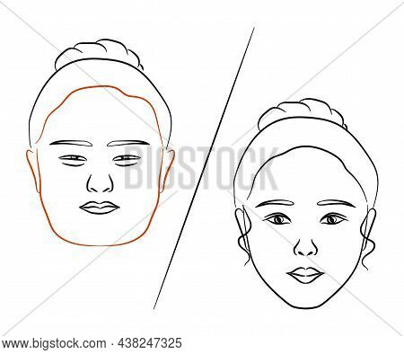 Woman's Face On A White Background. Plastic Surgery. Vector Illustration.