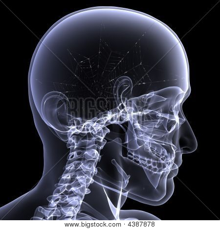 Radiographie squelette-Webs