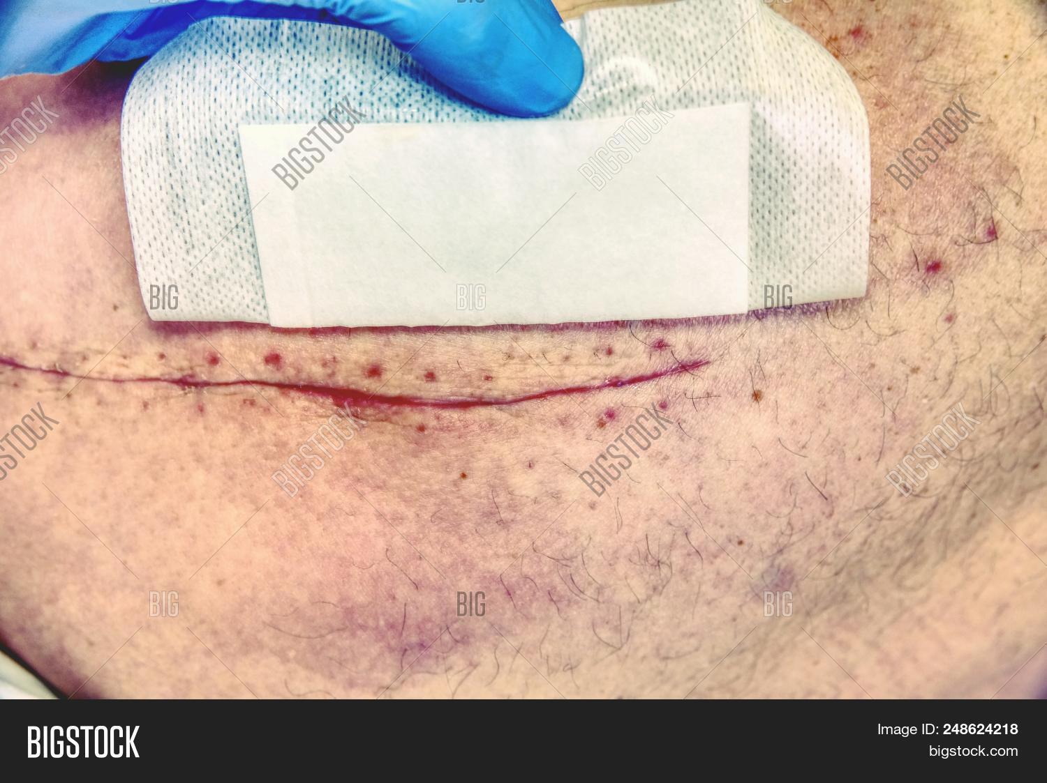 Patient Fresh Long Image & Photo (Free Trial) | Bigstock
