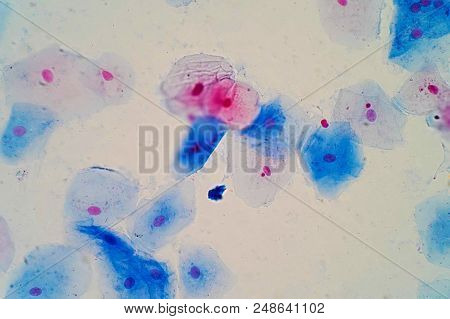 Squamous Epithelial Cells Under Microscope View For Education Histology. Human Tissue.