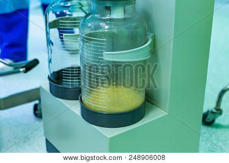 Bottles For The Fat Liquid From Liposuction