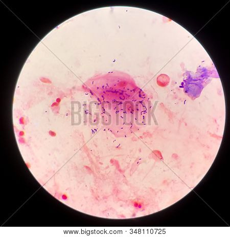 Gram Positive Bacilli On Red Background From Specimen Sputum.