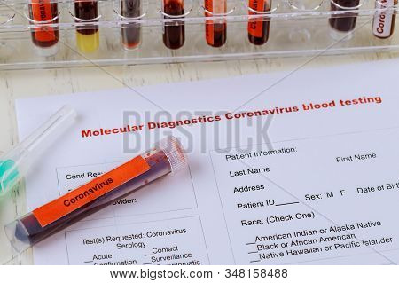 2019-ncov From China The Virus Causes Atypical Pneumonia Complete Blood Count Test Tubes