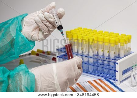 Coronavirus 2019-ncov World Outbreak Tests On Microbiology Lab. Chemist With Protective Green Unifor