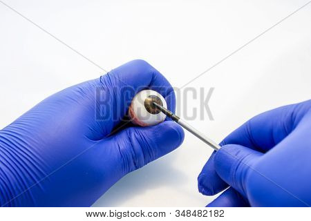 Doctor Or Scientist Holds In Gloved Hand Anatomical Model Of Eye And Points With Pointer On Center O
