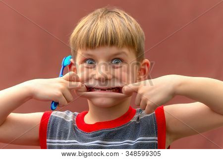 A Child With A Toothbrush In His Hand Shows A Toothless Mouth Swelling His Cheeks