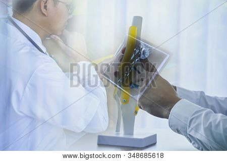 Doctor Leraning Bone X-ray Film And Physiotherapist Holding A Spine Model In Clinic.