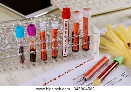 2019-ncov From China The Virus Causes Atypical Pneumonia Complete Blood Count Test Tubes