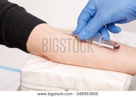 Close-up shot of doctor or nurse collecting blood from arm vein of a patient with a vacutainer. Venipuncture or venepuncture medical procedure