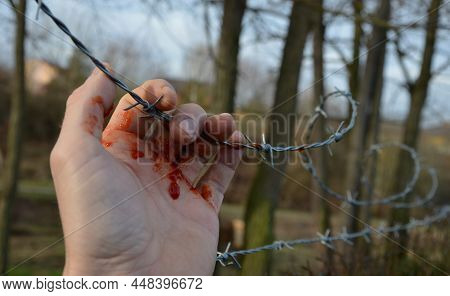 The Thief Grabbed The Newly Stretched Barbed Wire And Bled From His Hand. Another Attempt To Get Beh