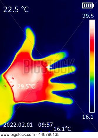 A Thermographic Image Of A Hand With A Human Heart, Showing Different Temperatures In Different Colo