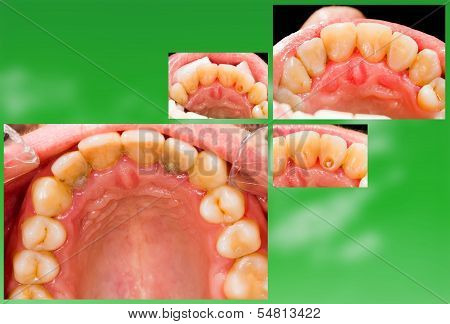 Health Treatment