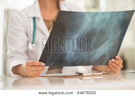 Closeup On Medical Doctor Woman Holding Fluorography