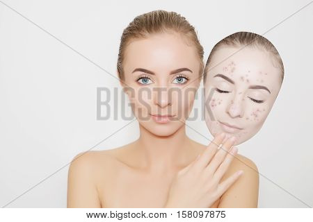 woman put away  bad sking with pimples