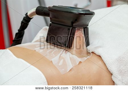 Woman Getting Cryolipolysis Fat Treatment Procedure In Professional Cosmetic Cabinet Or Spa Center